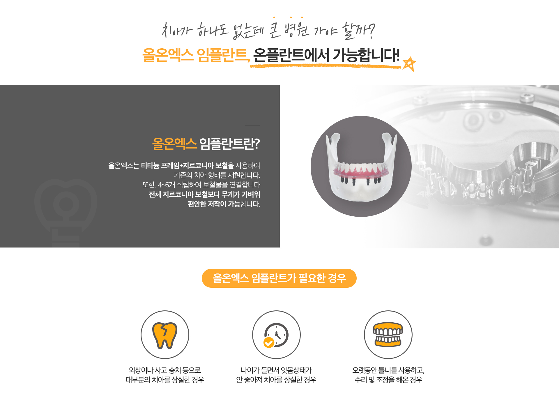 올온엑스 임플란트
