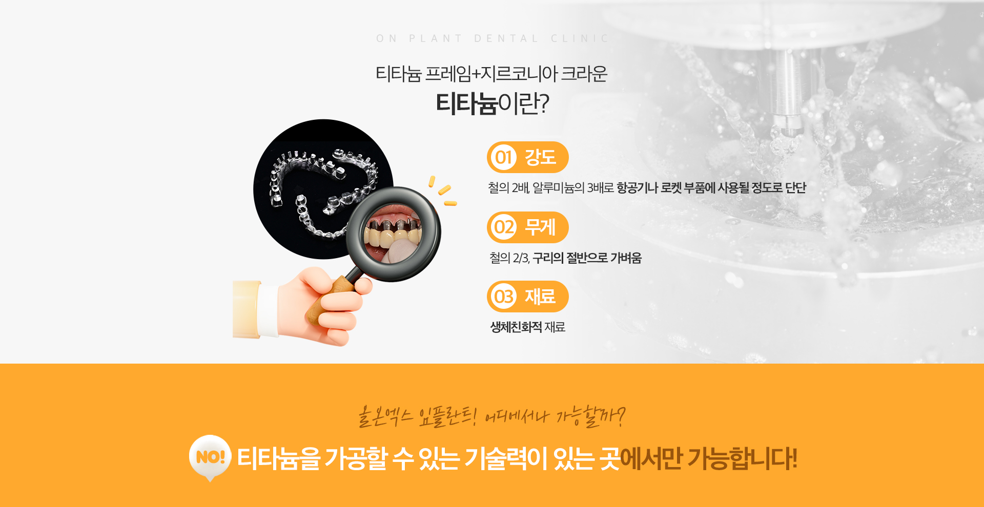 올온엑스 임플란트